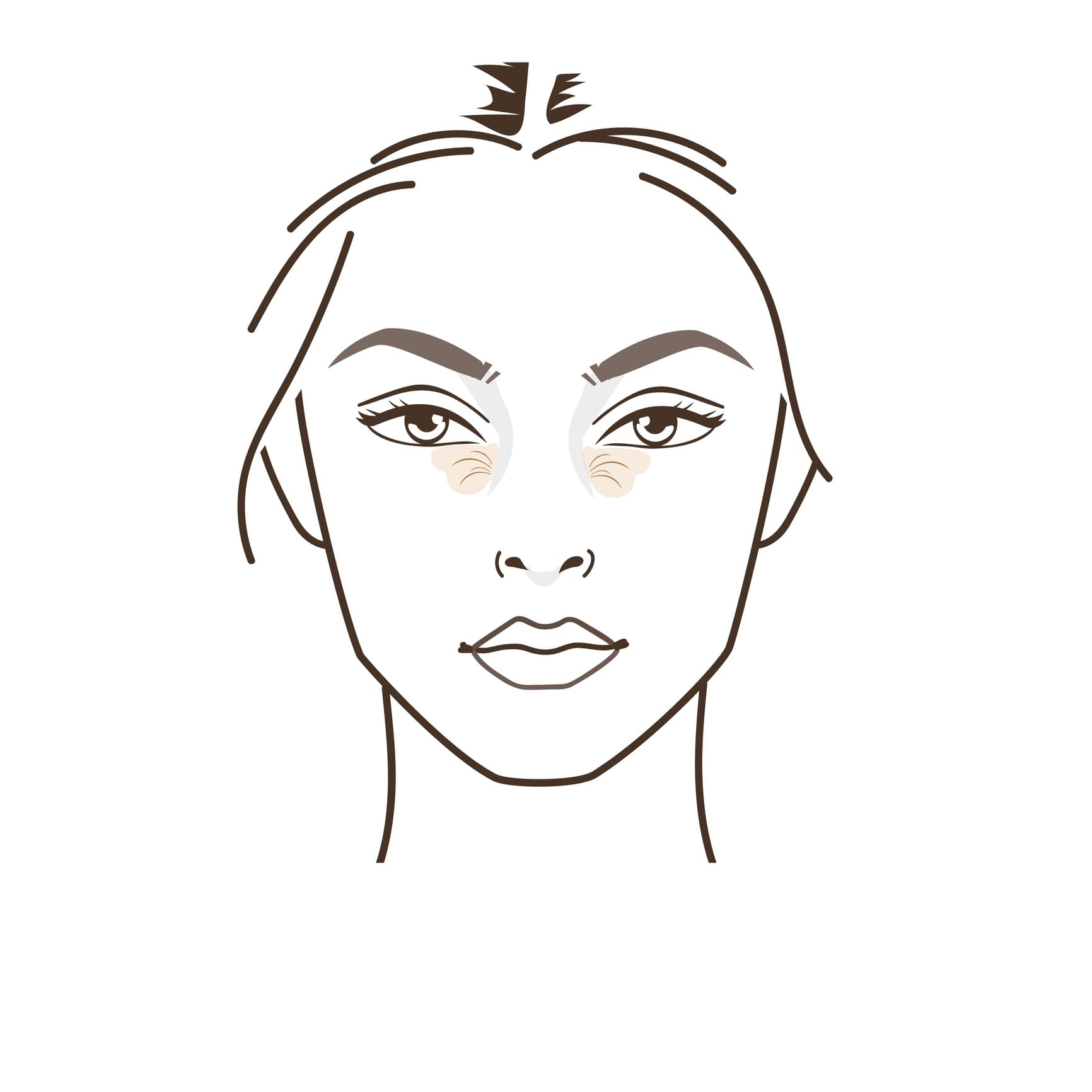 Botox for Bunny Lines in Vienna, VA | Aura Medspa — photo 1